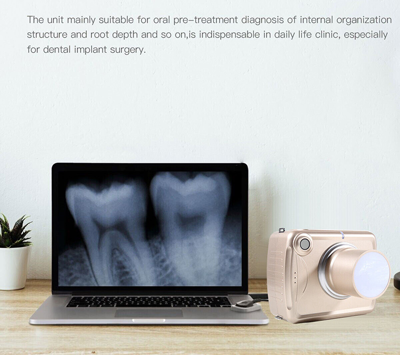 Dental Digital Portable X Ray Camera High Frequency Dentist Intraoral Imaging Unit